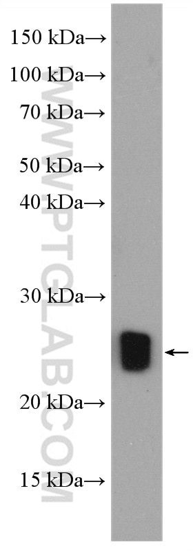 Western Blot (WB) analysis of mouse brain tissue using RAB4A Polyclonal antibody (10347-1-AP)