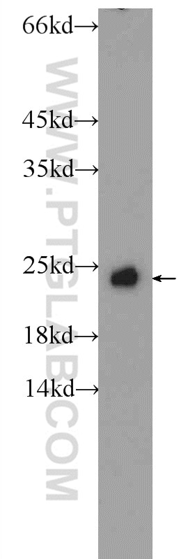 RAB4A Polyclonal antibody