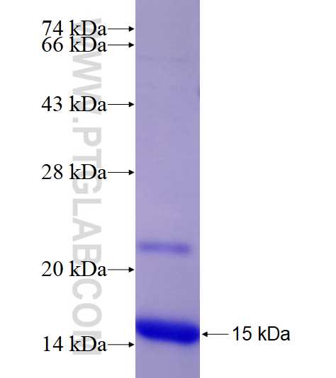 RAB4A fusion protein Ag23117 SDS-PAGE