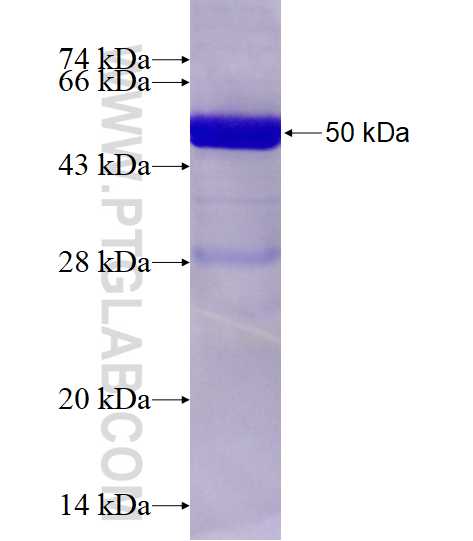 RAB4A fusion protein Ag0357 SDS-PAGE