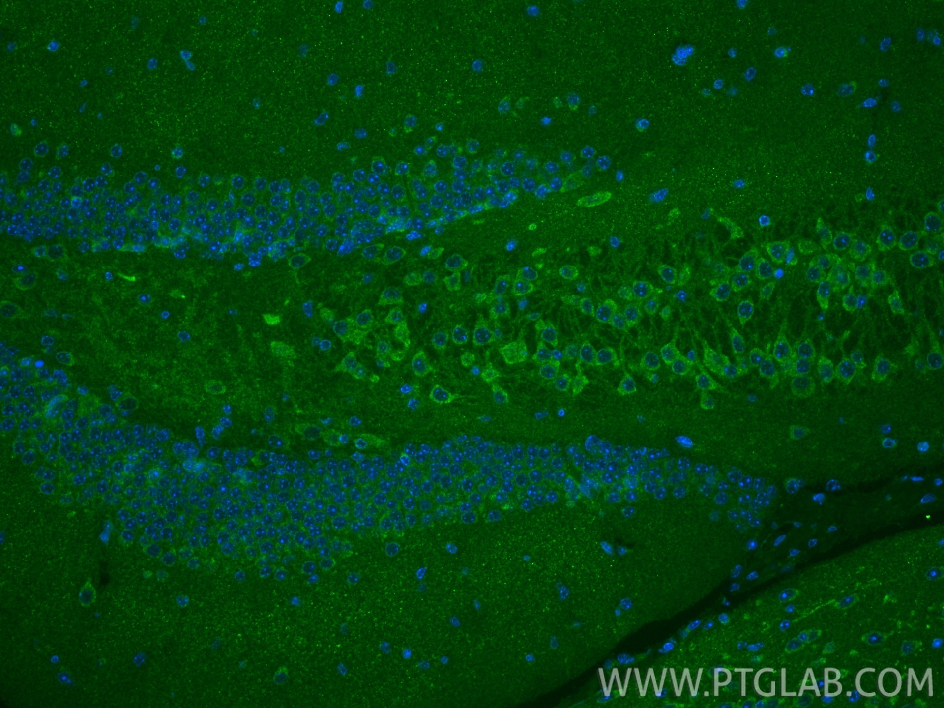 Immunofluorescence (IF) / fluorescent staining of mouse brain tissue using RAB5A Polyclonal antibody (11947-1-AP)