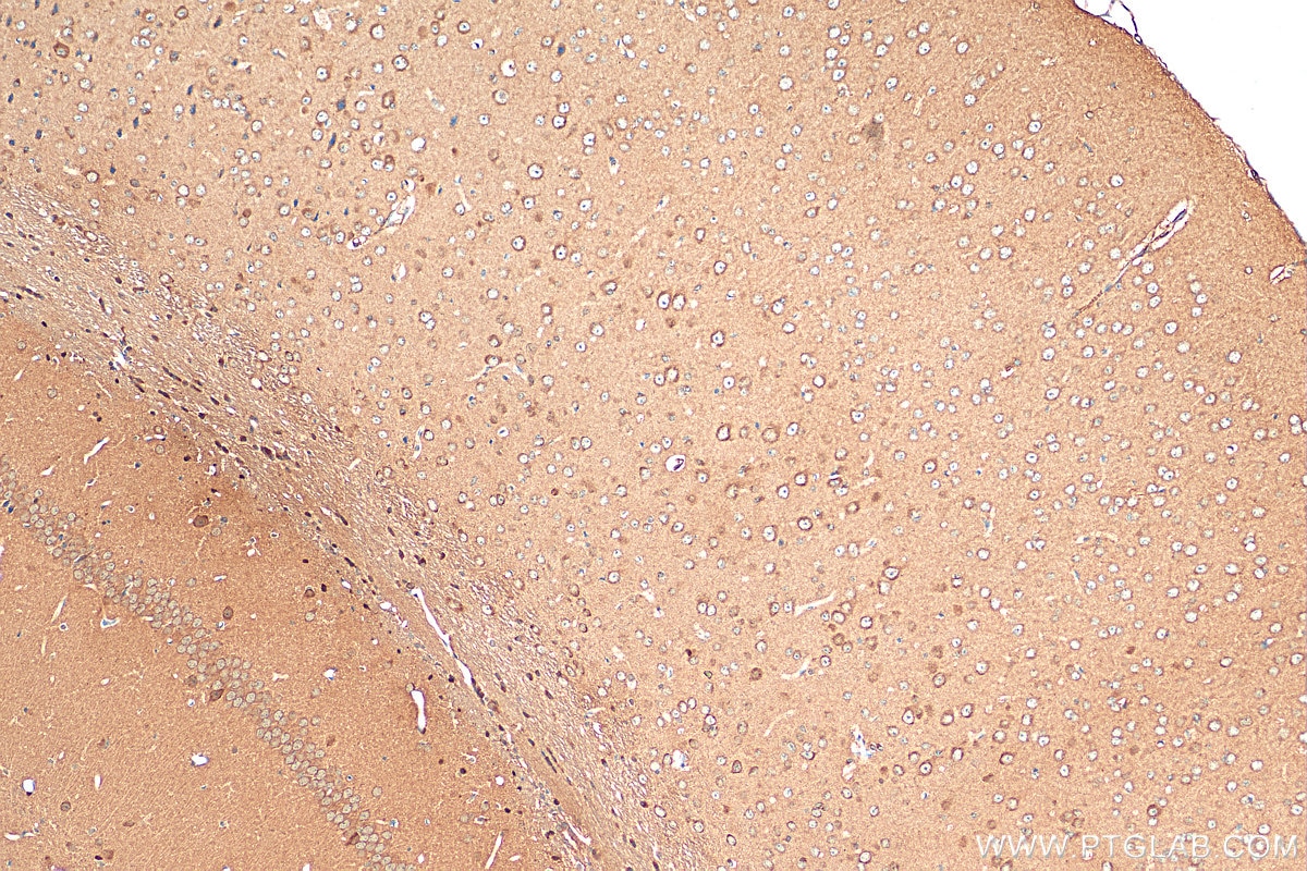 Immunohistochemistry (IHC) staining of mouse brain tissue using RAB5A Polyclonal antibody (11947-1-AP)