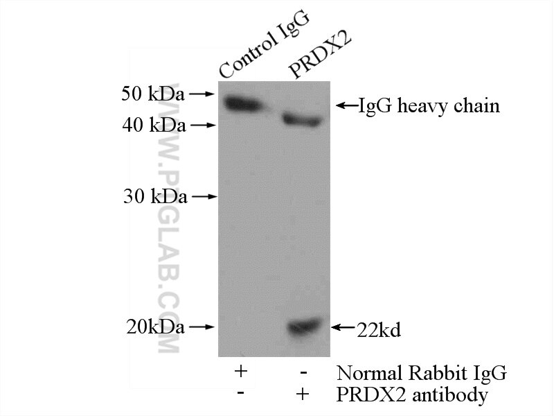 Immunoprecipitation (IP) experiment of mouse brain tissue using RAB5A Polyclonal antibody (11947-1-AP)