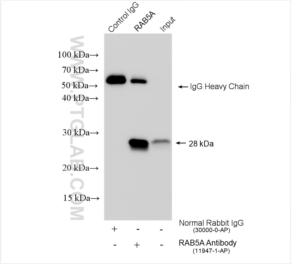 Immunoprecipitation (IP) experiment of mouse brain tissue using RAB5A Polyclonal antibody (11947-1-AP)