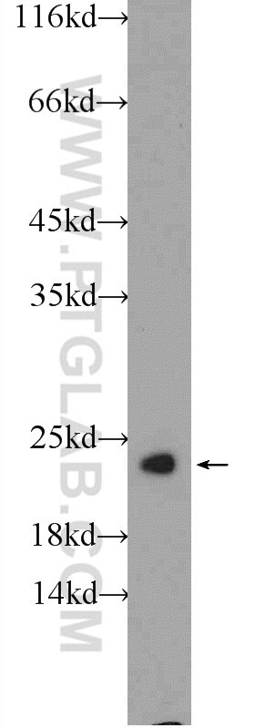 Western Blot (WB) analysis of rat brain tissue using RAB5A Polyclonal antibody (11947-1-AP)