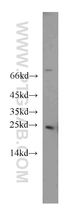 Western Blot (WB) analysis of HeLa cells using RAB5A Polyclonal antibody (11947-1-AP)