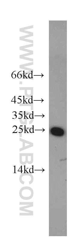 RAB5A Polyclonal antibody