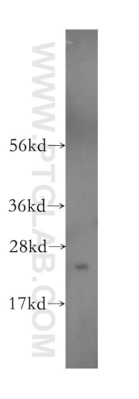 Western Blot (WB) analysis of human brain tissue using RAB5A Polyclonal antibody (11947-1-AP)