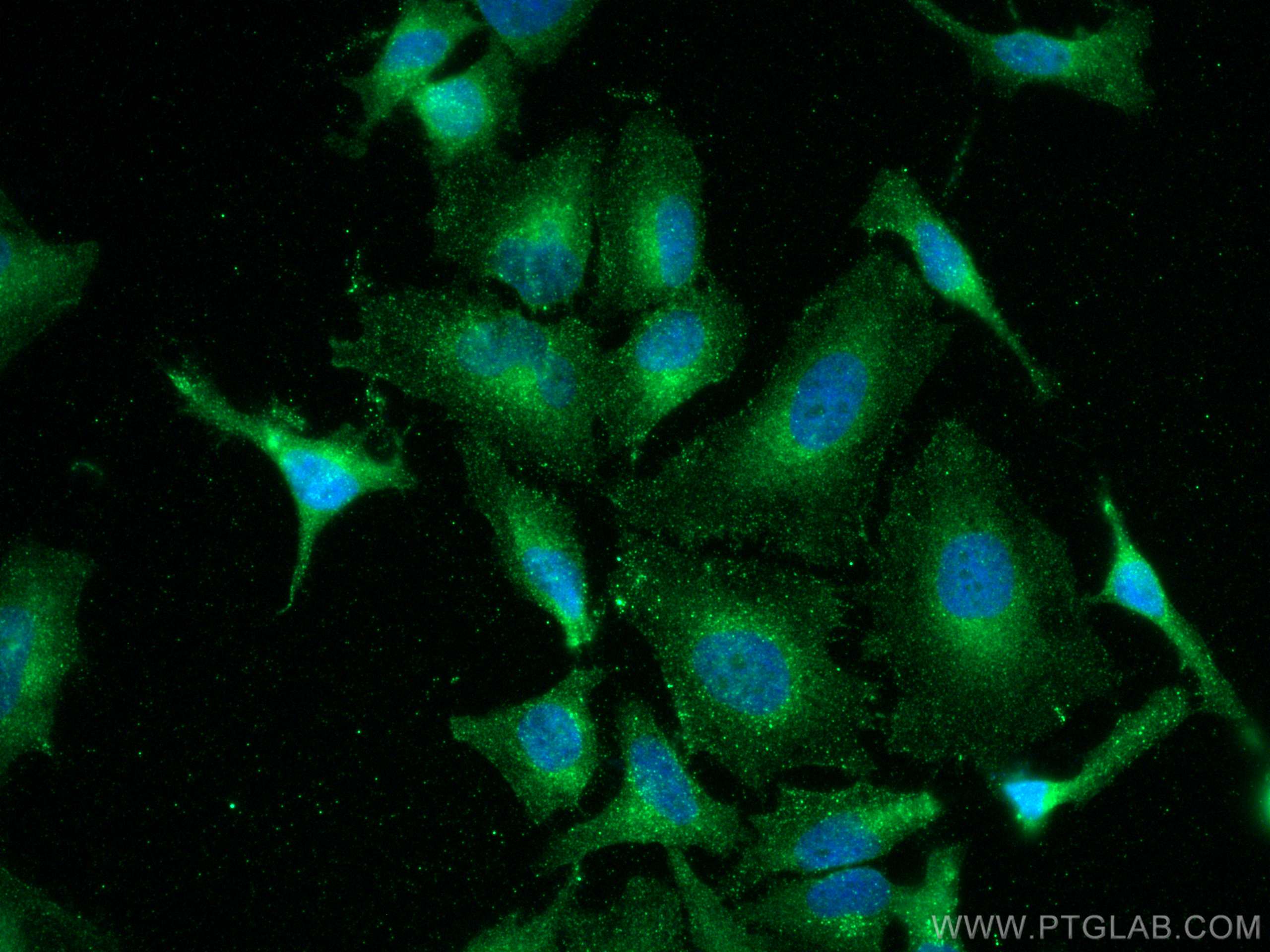 Immunofluorescence (IF) / fluorescent staining of HeLa cells using RAB5A Monoclonal antibody (66339-1-Ig)