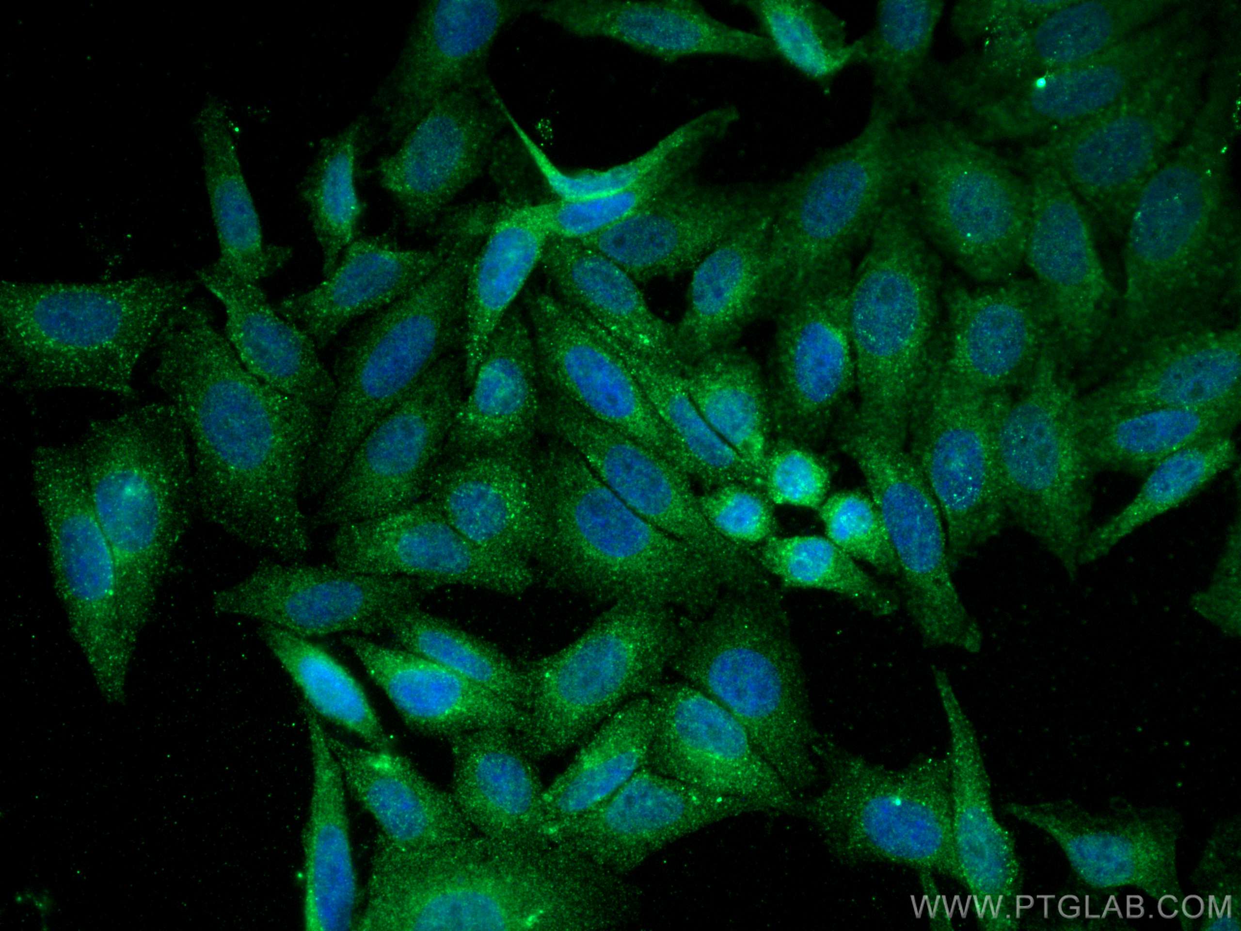 Immunofluorescence (IF) / fluorescent staining of HepG2 cells using RAB5A Monoclonal antibody (66339-1-Ig)