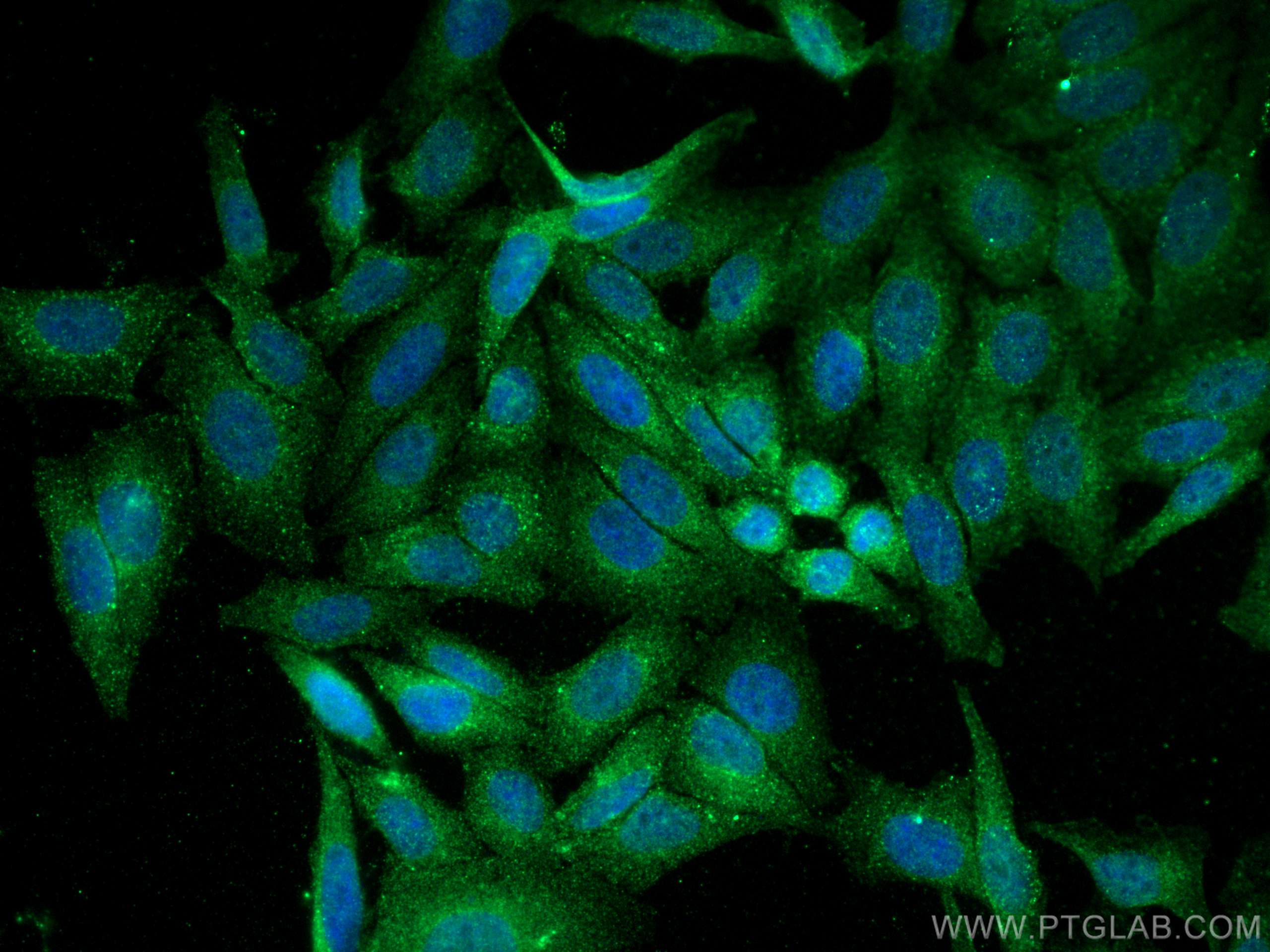 IF Staining of HepG2 using 66339-1-Ig