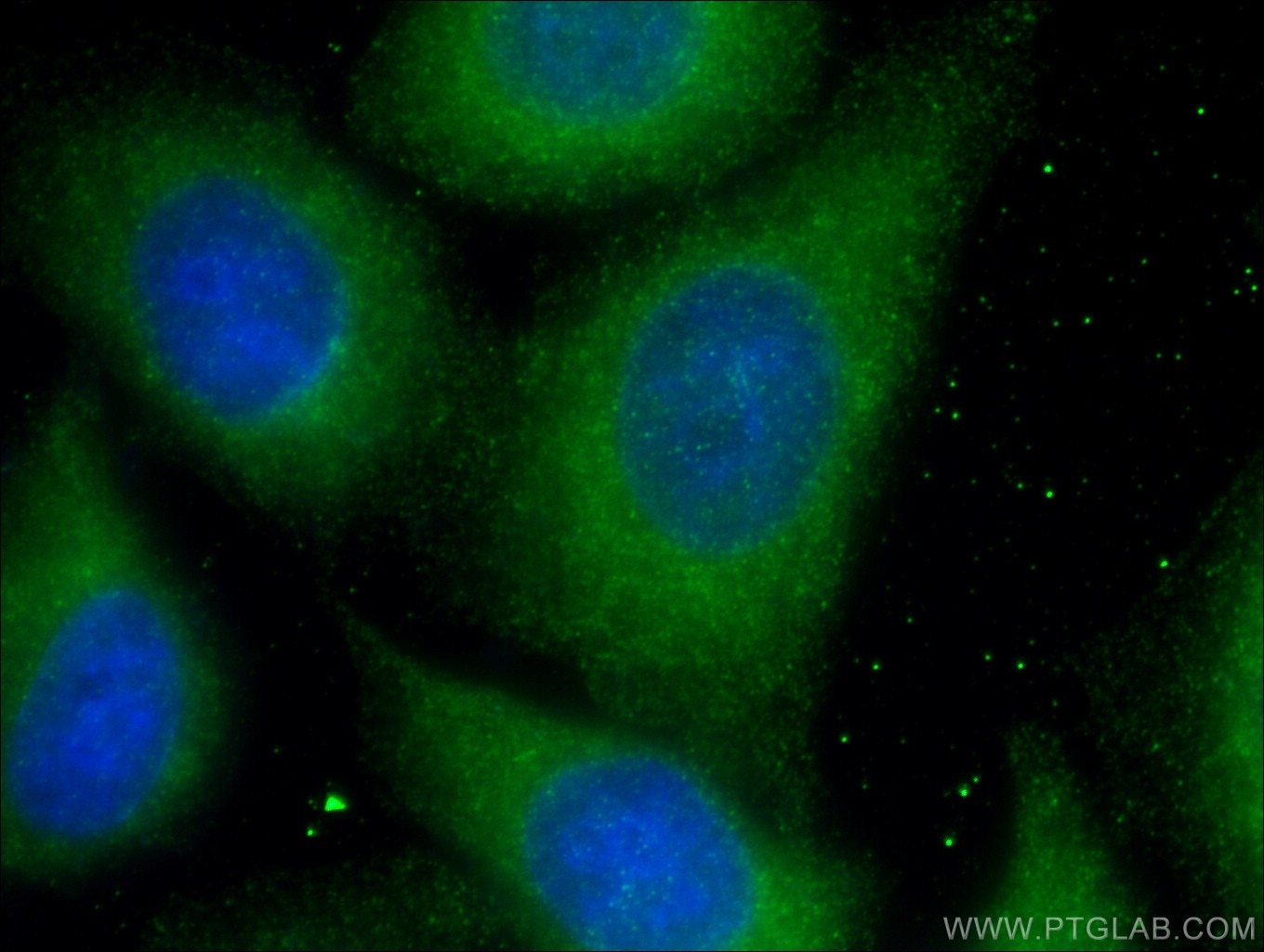 Immunofluorescence (IF) / fluorescent staining of HepG2 cells using RAB5A Monoclonal antibody (66339-1-Ig)