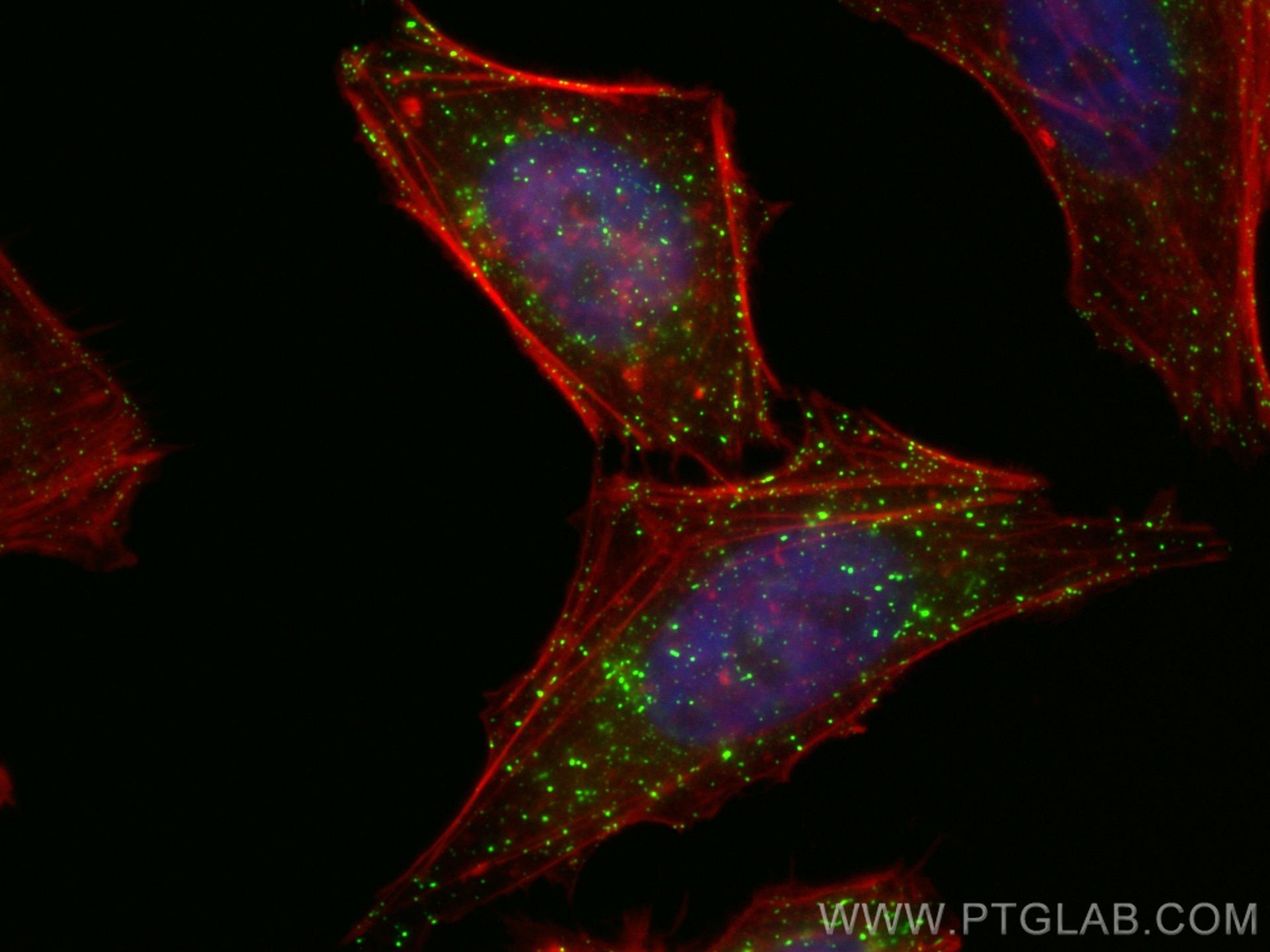 Immunofluorescence (IF) / fluorescent staining of HeLa cells using RAB5A Monoclonal antibody (66339-1-Ig)