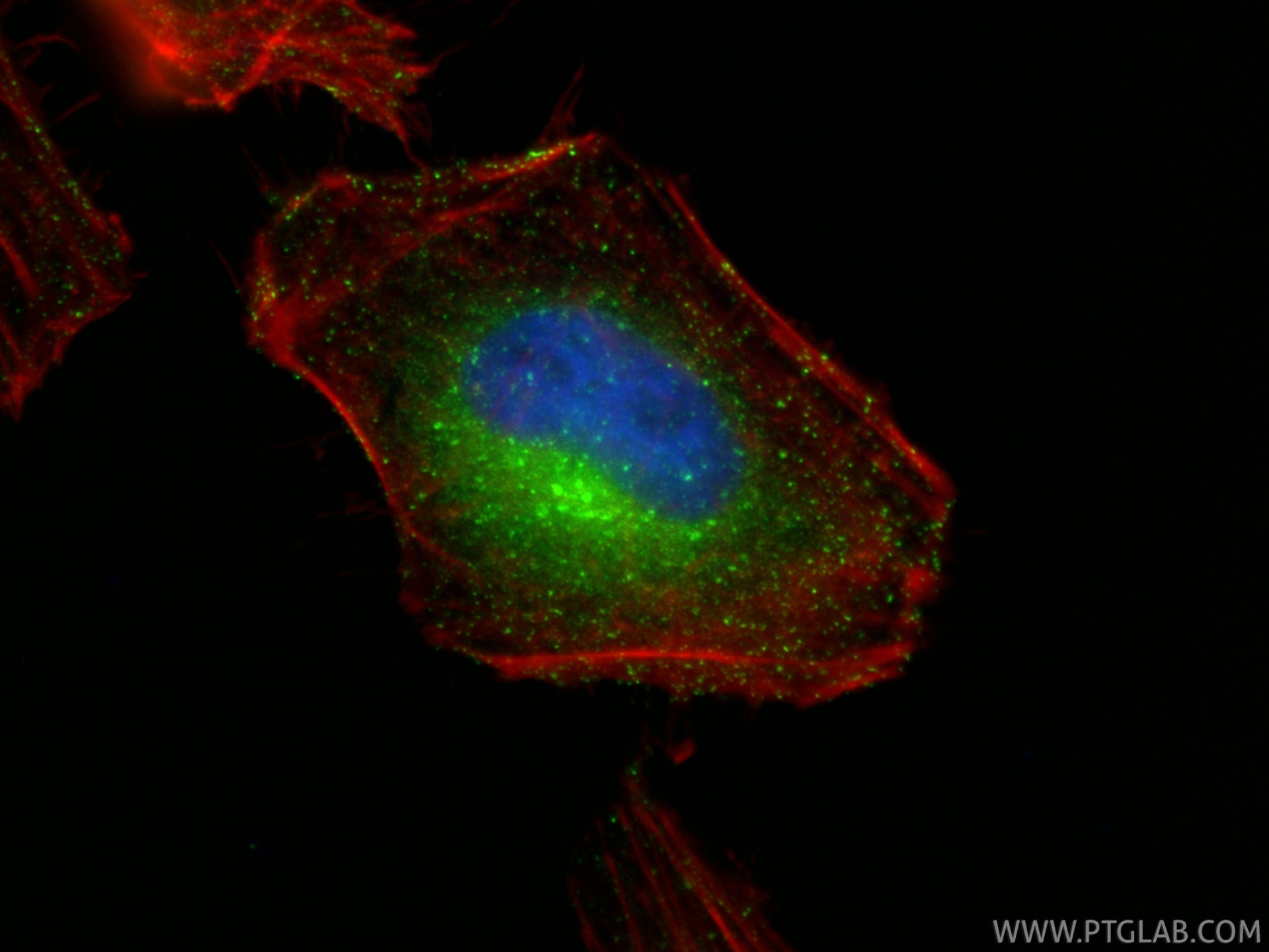 Immunofluorescence (IF) / fluorescent staining of HeLa cells using RAB5A Monoclonal antibody (66339-1-Ig)