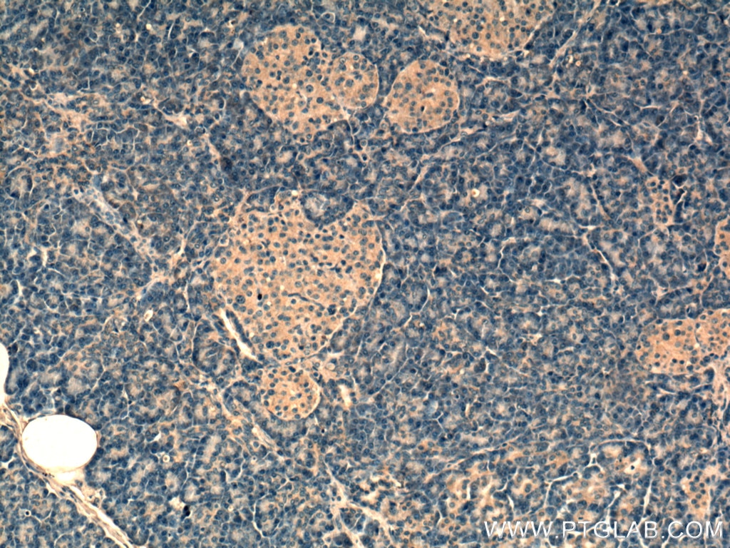 Immunohistochemistry (IHC) staining of human pancreas tissue using RAB5A Monoclonal antibody (66339-1-Ig)
