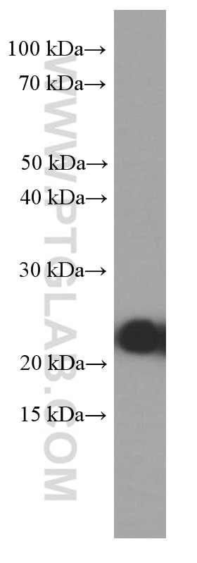 Western Blot (WB) analysis of HEK-293 cells using RAB5A Monoclonal antibody (66339-1-Ig)