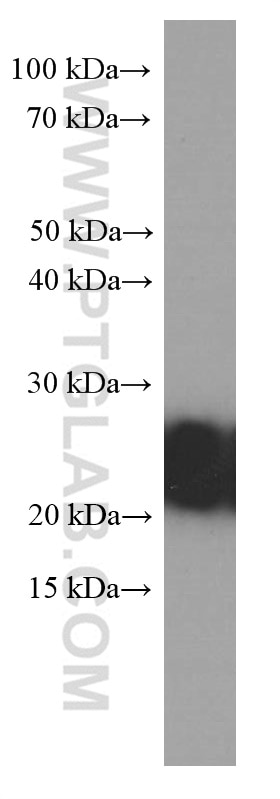 Western Blot (WB) analysis of fetal human brain tissue using RAB5A Monoclonal antibody (66339-1-Ig)