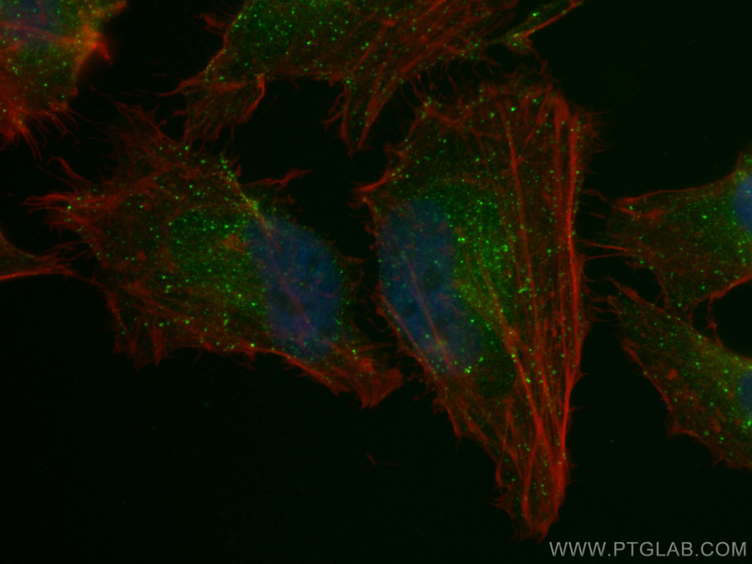 Immunofluorescence (IF) / fluorescent staining of HeLa cells using CoraLite® Plus 488-conjugated RAB5A Monoclonal ant (CL488-66339)