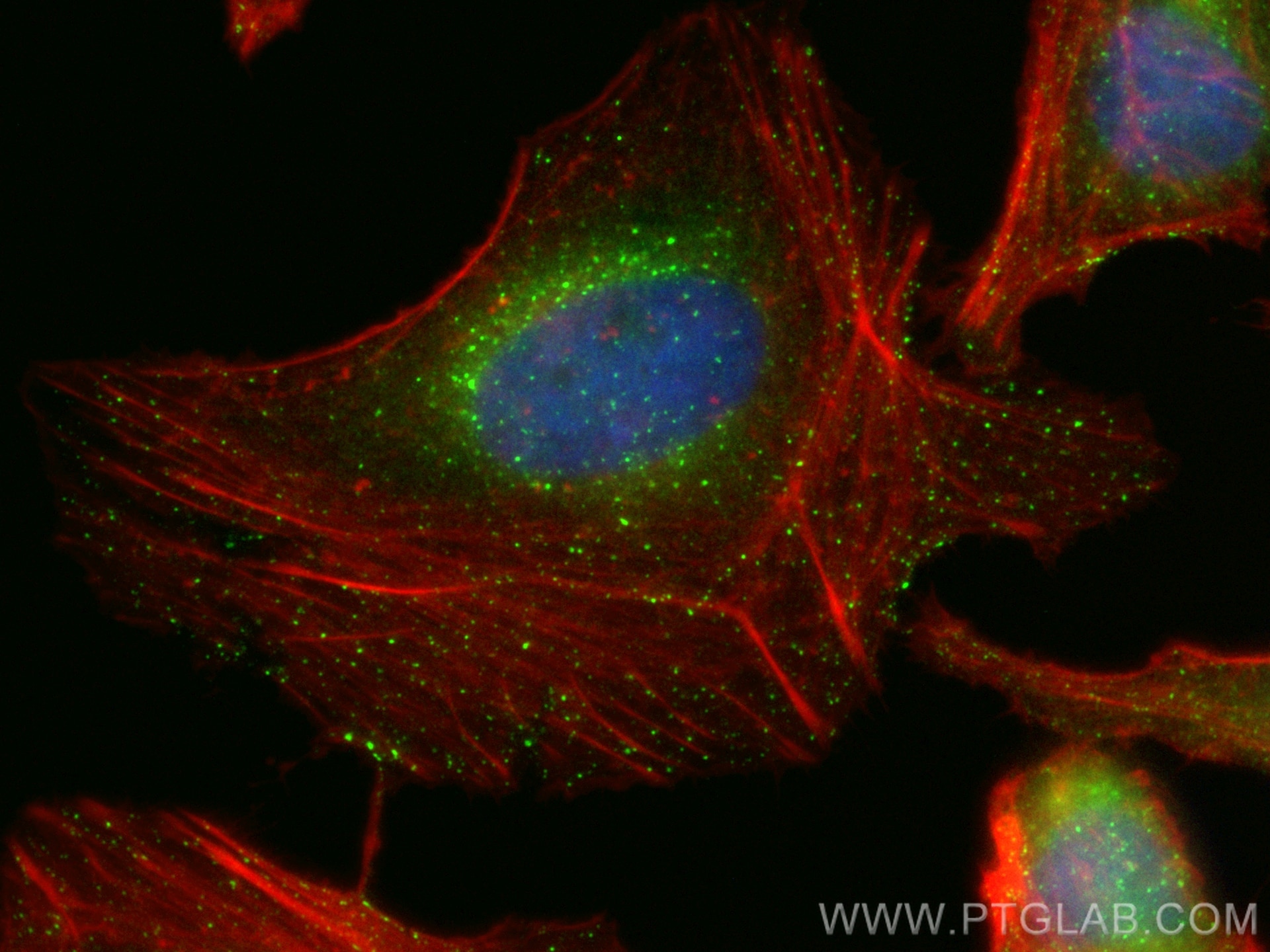 Immunofluorescence (IF) / fluorescent staining of HeLa cells using CoraLite® Plus 488-conjugated RAB5A Monoclonal ant (CL488-66339)