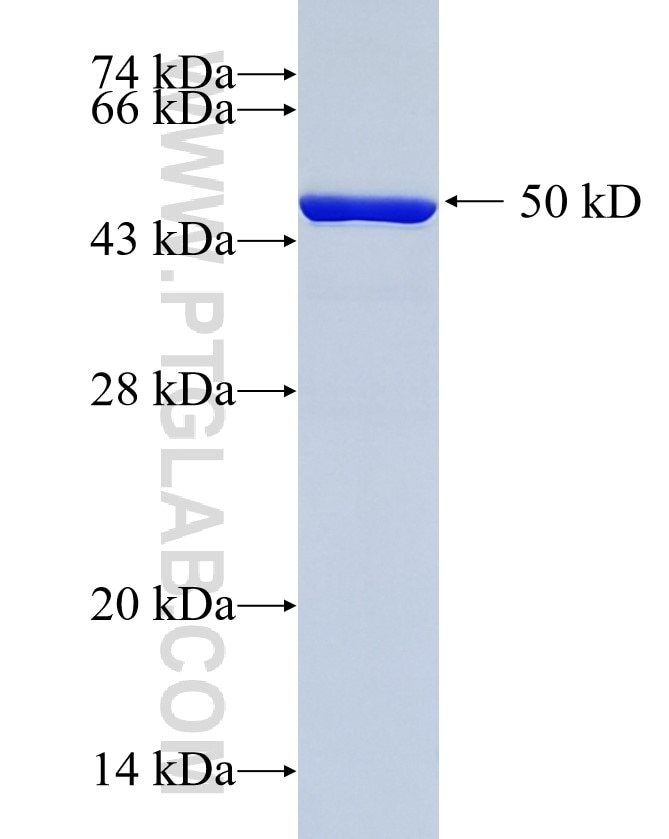 RAB5A fusion protein Ag2549 SDS-PAGE