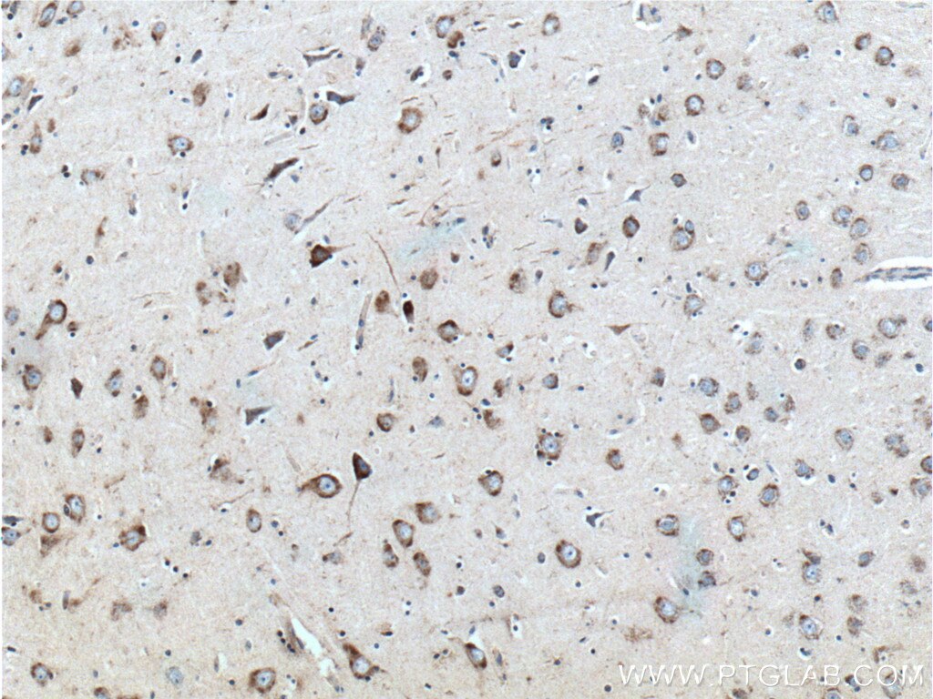 Immunohistochemistry (IHC) staining of human brain tissue using RAB5A-Specific Polyclonal antibody (20228-1-AP)