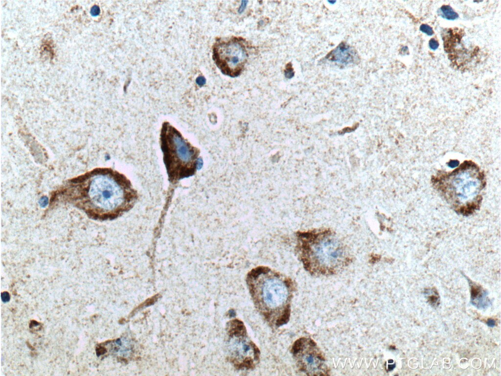 Immunohistochemistry (IHC) staining of human brain tissue using RAB5A-Specific Polyclonal antibody (20228-1-AP)