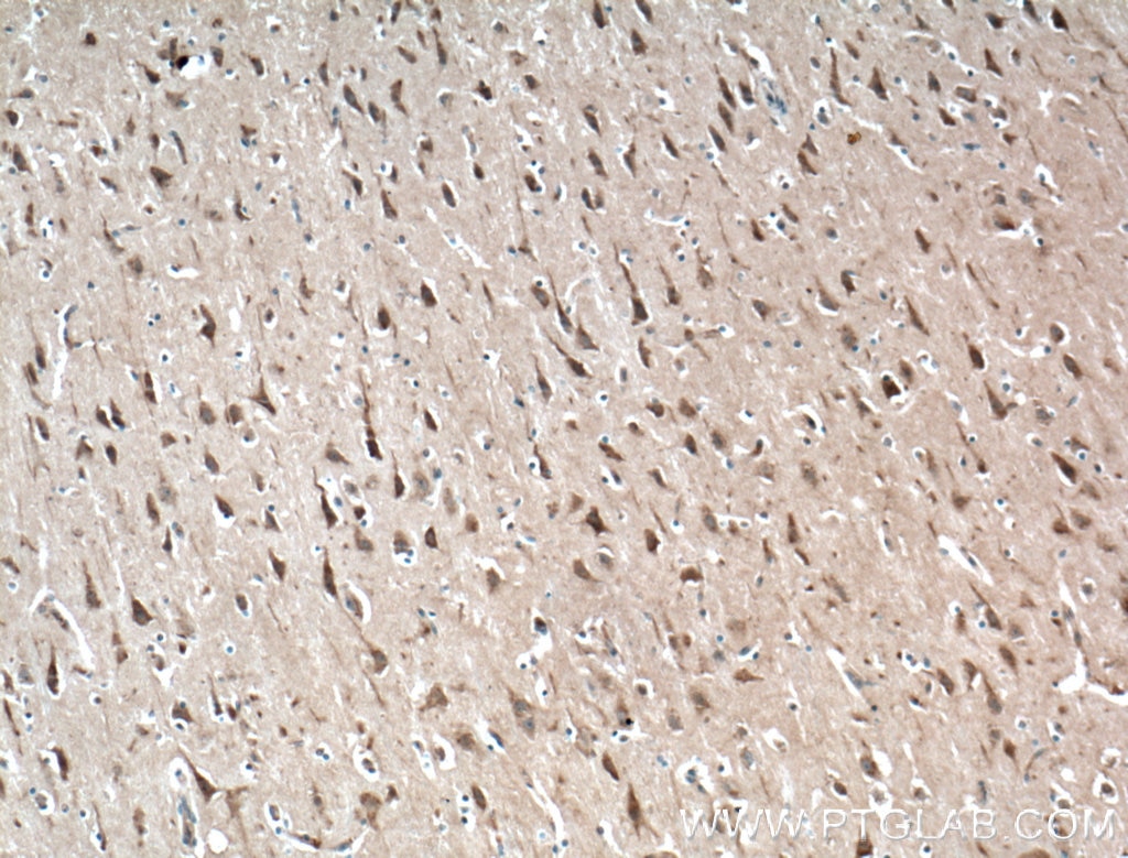 Immunohistochemistry (IHC) staining of human brain tissue using RAB5A-Specific Polyclonal antibody (20228-1-AP)
