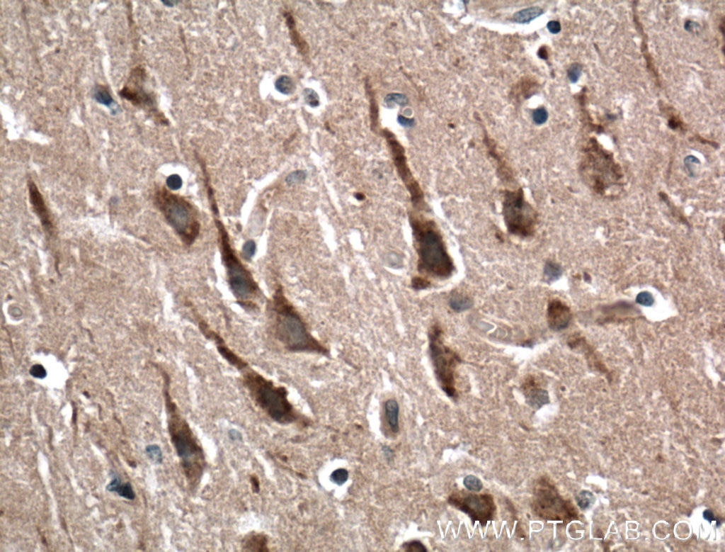 Immunohistochemistry (IHC) staining of human brain tissue using RAB5A-Specific Polyclonal antibody (20228-1-AP)
