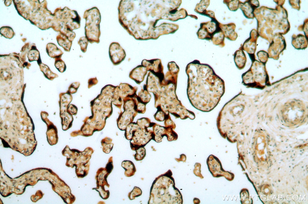 Immunohistochemistry (IHC) staining of human placenta tissue using RAB5A-Specific Polyclonal antibody (20228-1-AP)