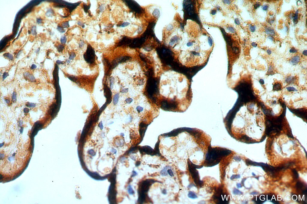 Immunohistochemistry (IHC) staining of human placenta tissue using RAB5A-Specific Polyclonal antibody (20228-1-AP)