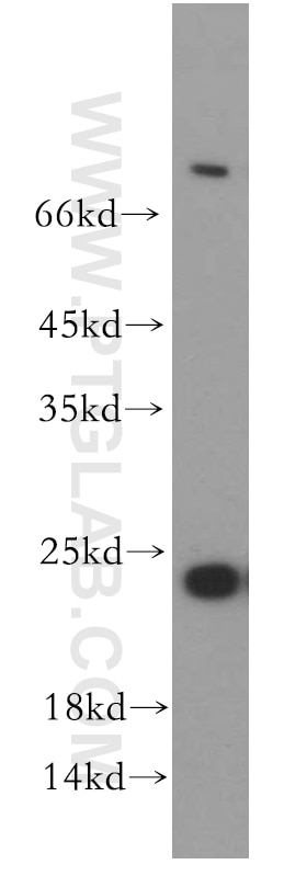 Western Blot (WB) analysis of human brain tissue using RAB5A-Specific Polyclonal antibody (20228-1-AP)