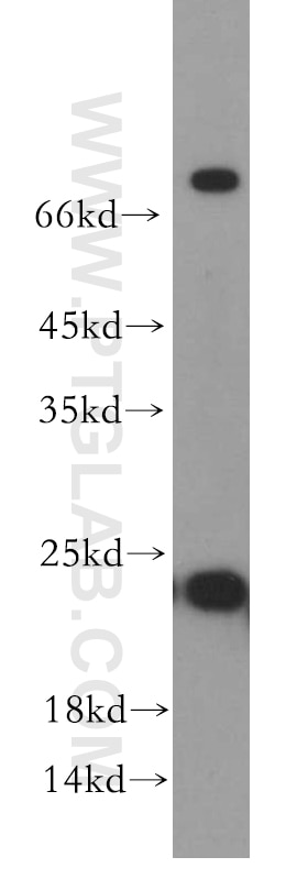 Western Blot (WB) analysis of human brain tissue using RAB5A-Specific Polyclonal antibody (20228-1-AP)