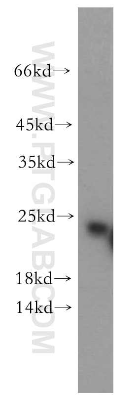 Western Blot (WB) analysis of mouse colon tissue using RAB5A-Specific Polyclonal antibody (20228-1-AP)