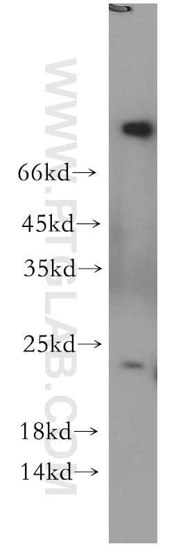 Western Blot (WB) analysis of SH-SY5Y cells using RAB5A-Specific Polyclonal antibody (20228-1-AP)