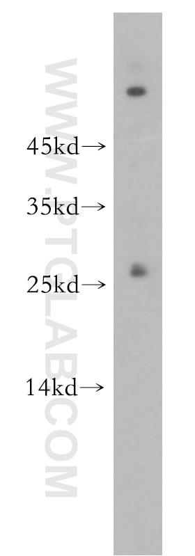 RAB5B Polyclonal antibody