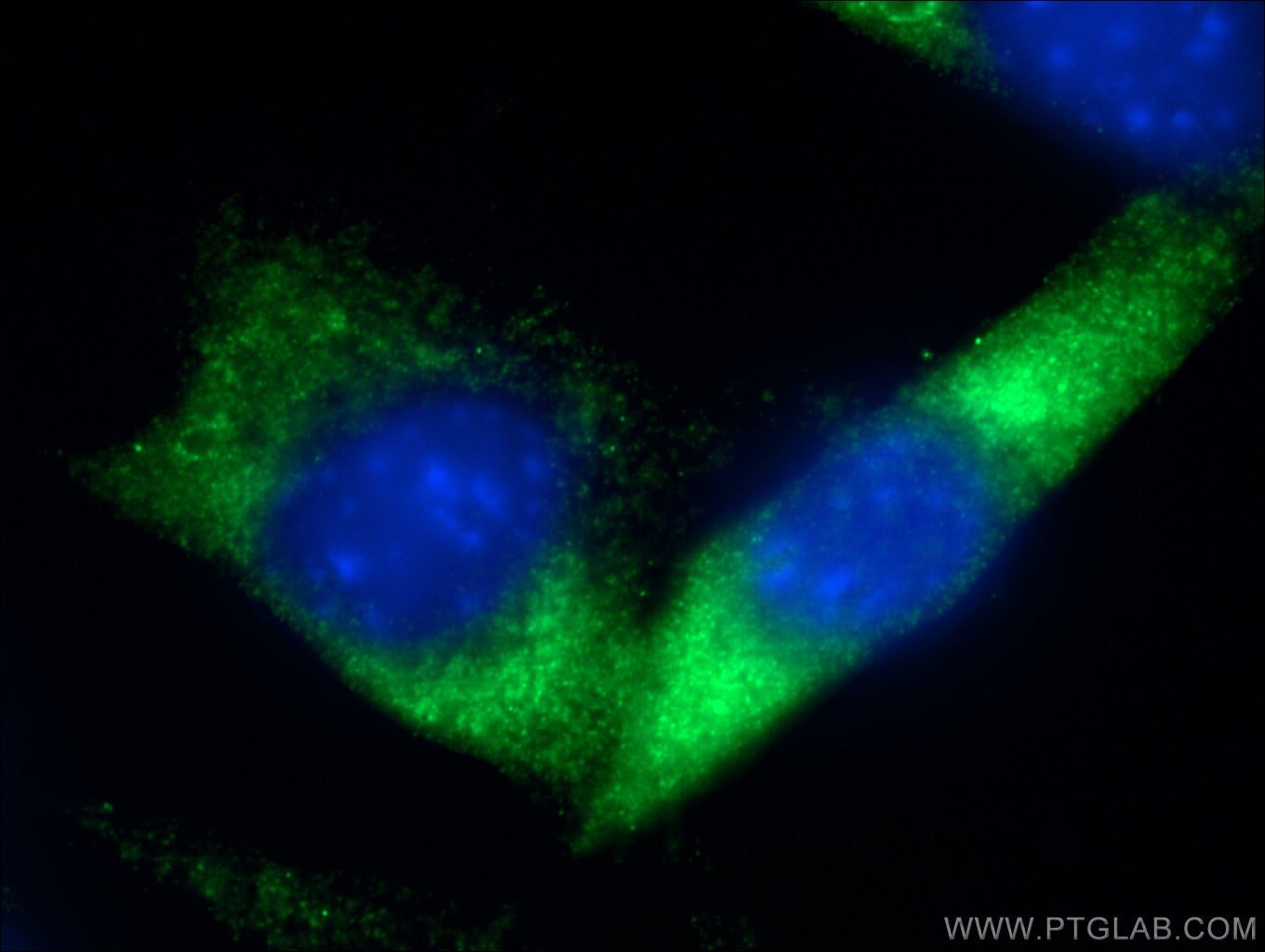 Immunofluorescence (IF) / fluorescent staining of NIH/3T3 cells using RAB5B Polyclonal antibody (27403-1-AP)
