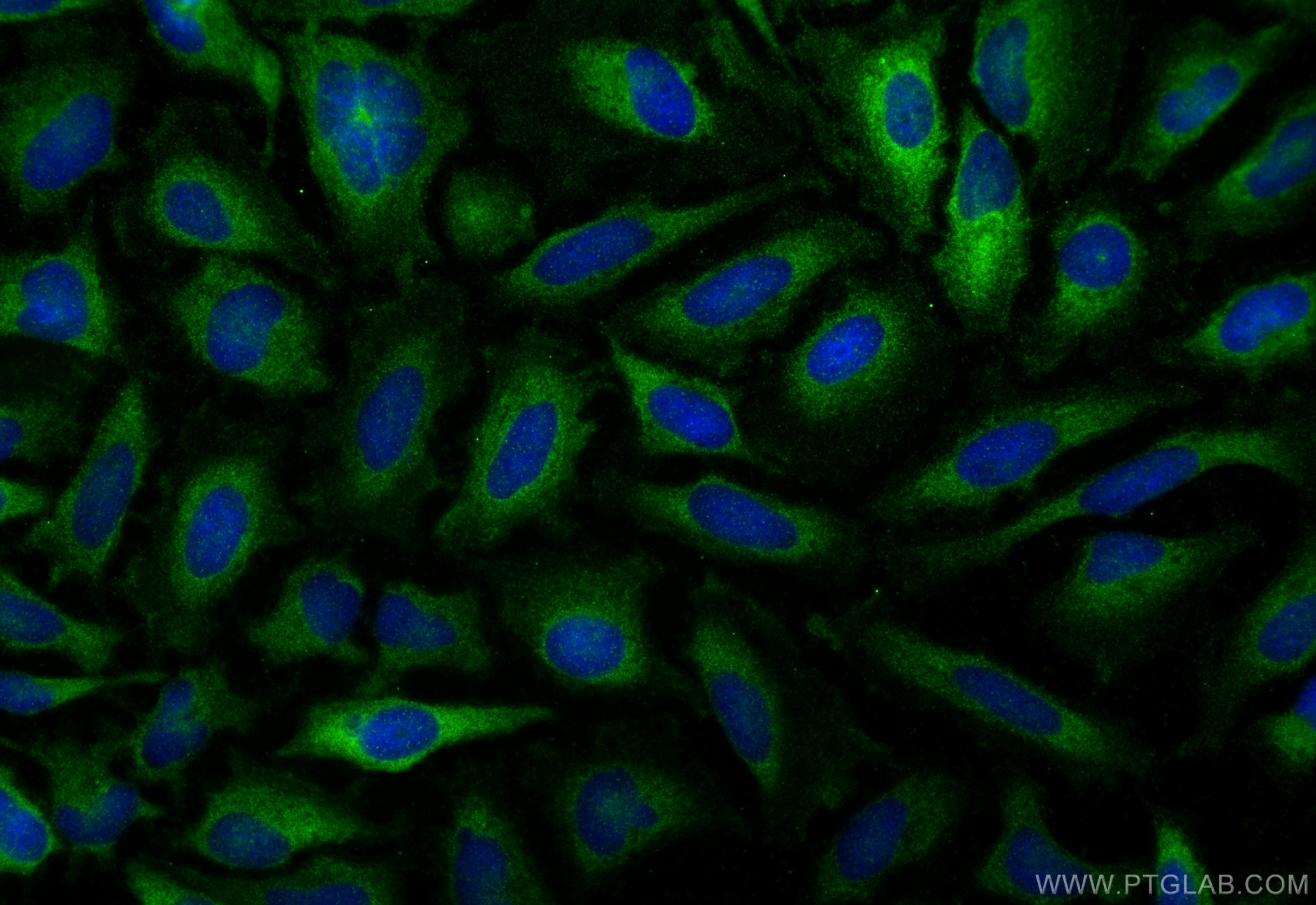 Immunofluorescence (IF) / fluorescent staining of HeLa cells using RAB5B Polyclonal antibody (27403-1-AP)