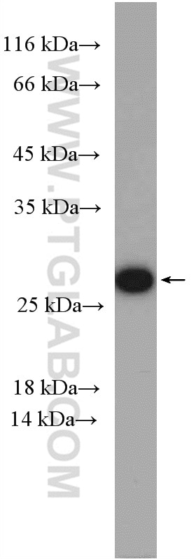 Western Blot (WB) analysis of Jurkat cells using RAB5B Polyclonal antibody (27403-1-AP)