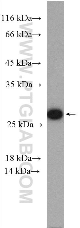 WB analysis of Jurkat using 27403-1-AP