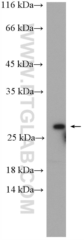 Western Blot (WB) analysis of HeLa cells using RAB5B Polyclonal antibody (27403-1-AP)