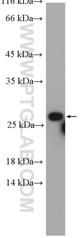 Western Blot (WB) analysis of HepG2 cells using RAB5B Polyclonal antibody (27403-1-AP)