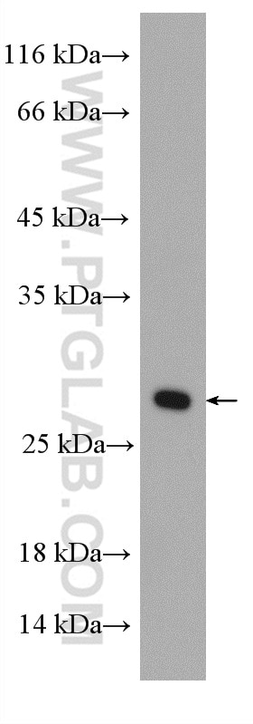 Western Blot (WB) analysis of NIH/3T3 cells using RAB5B Polyclonal antibody (27403-1-AP)