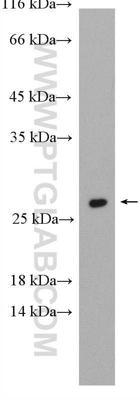 Western Blot (WB) analysis of HEK-293 cells using RAB5B Polyclonal antibody (27403-1-AP)