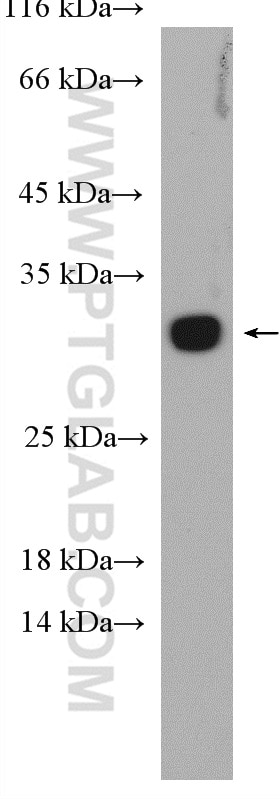 Western Blot (WB) analysis of mouse lung tissue using RAB5B Polyclonal antibody (27403-1-AP)