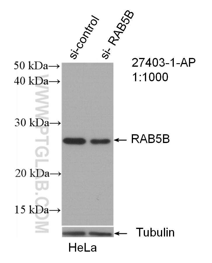 Western Blot (WB) analysis of HeLa cells using RAB5B Polyclonal antibody (27403-1-AP)