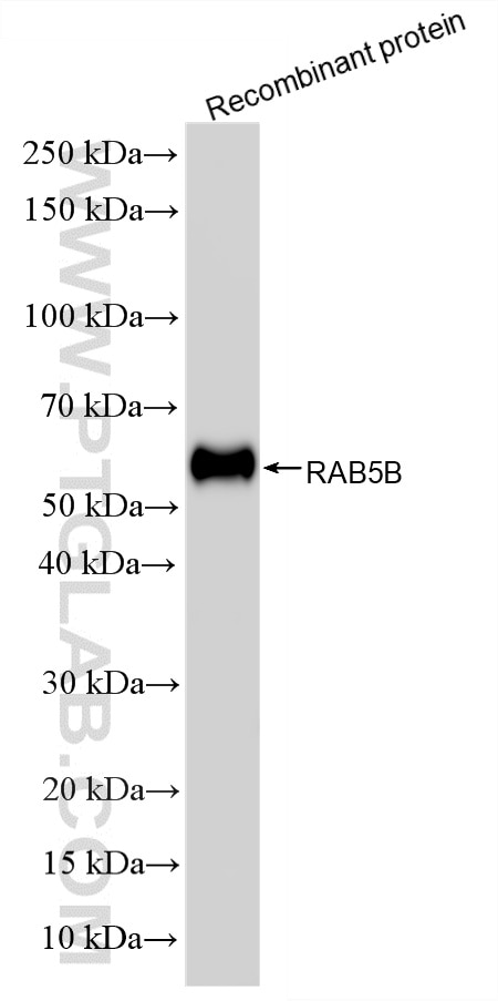 WB analysis using 86951-1-RR Western Blot (WB) analysis of various lysates using RAB5B Recombinant monoclonal antibody (86951-1-RR)