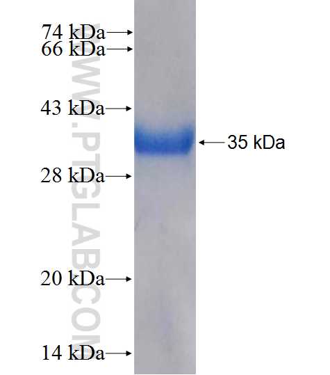 RAB5B fusion protein Ag26584 SDS-PAGE