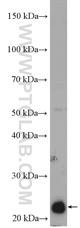 Western Blot (WB) analysis of A549 cells using RAB5C Polyclonal antibody (27219-1-AP)