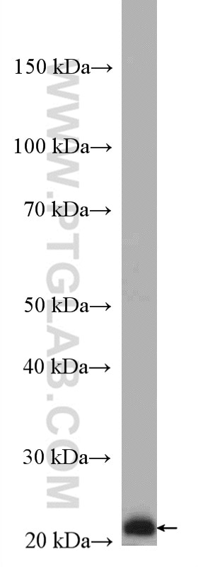 Western Blot (WB) analysis of U-937 cells using RAB5C Polyclonal antibody (27219-1-AP)