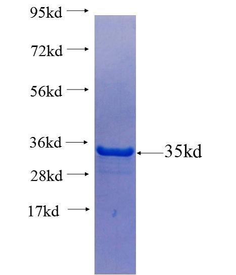 RAB5C fusion protein Ag25849 SDS-PAGE